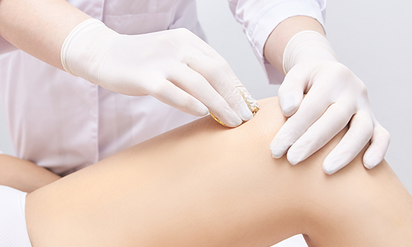 콜라겐 강화요법