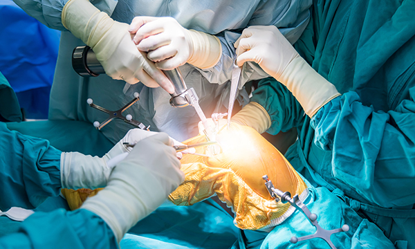 콜라겐 강화요법