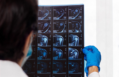 MRI(자기공명영상)